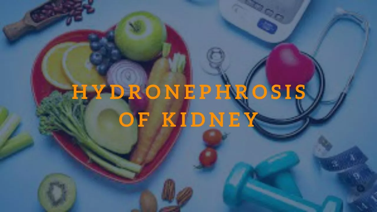 Hydronephrosis of Kidney