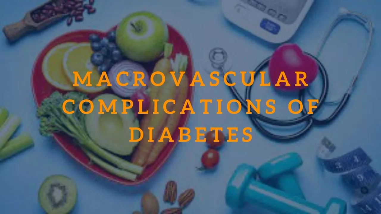 Macrovascular Complications of Diabetes