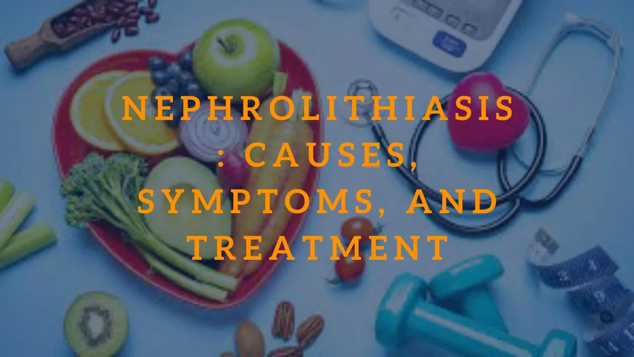 Nephrolithiasis: Causes, Symptoms, and Treatment