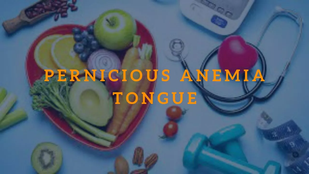 Pernicious Anemia Tongue